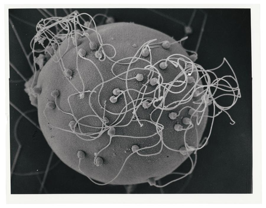 Electron photomicrograph of human egg and sperm cells.