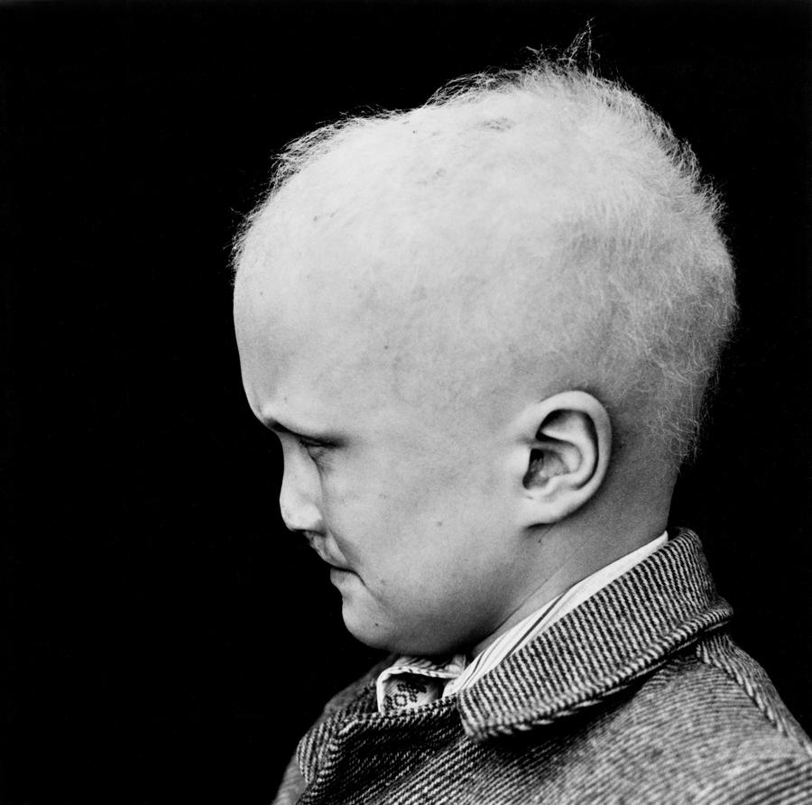 The side of a boy's face, he is wearing a jacket