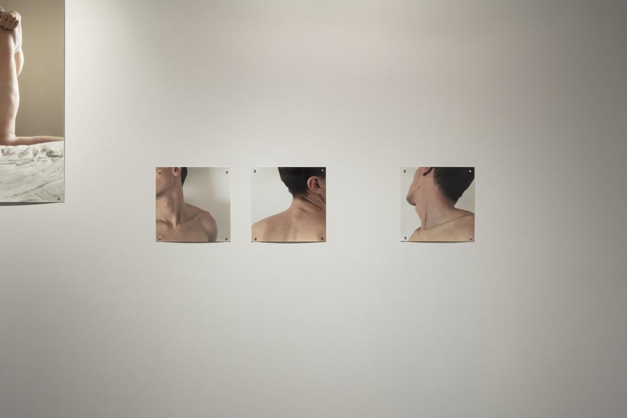 Three square photographs of a man's neck, shoulders, and back