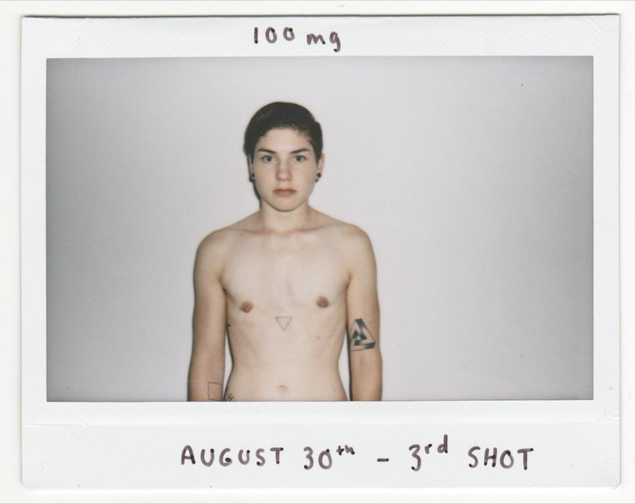 A shirtless man in front of a white wall staring at the camera. The handwritten text reads "100 mg. August 30. 3rd shot."